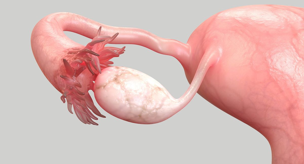 3D render of a uterus, ovary, and tube.