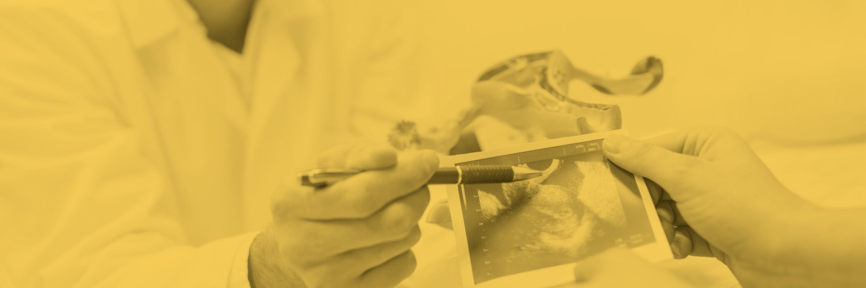 Ultrasound images printed on thermal paper